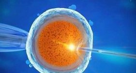 卵巢早衰能做试管助孕吗(做试管助孕成功率有多少)