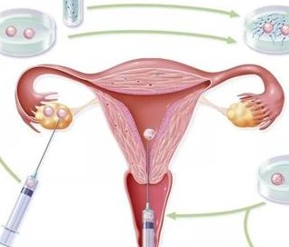 第三代试管婴儿要多少费用？生孩子孩费用十万够吗？